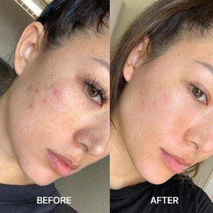 BOYA Professional Care Q10 Serum Soap